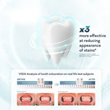 Seen Pro Ultimate Whitening Toothbrush 2pk Soft Yellow & White